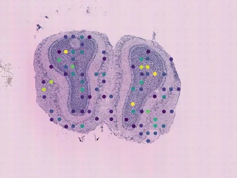 Mouse brain preview