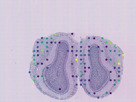 Mouse brain preview
