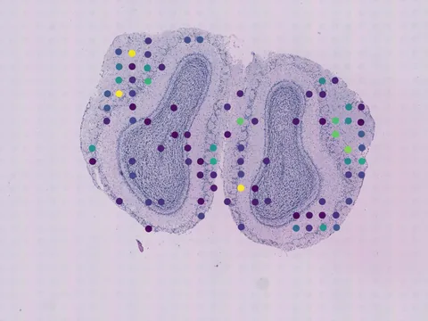 Mouse brain preview