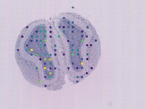 Mouse brain preview
