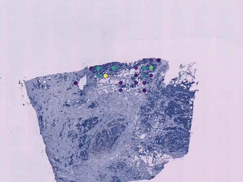 Human breast preview