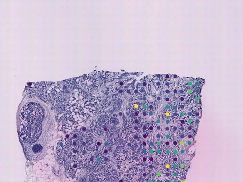 Human breast preview