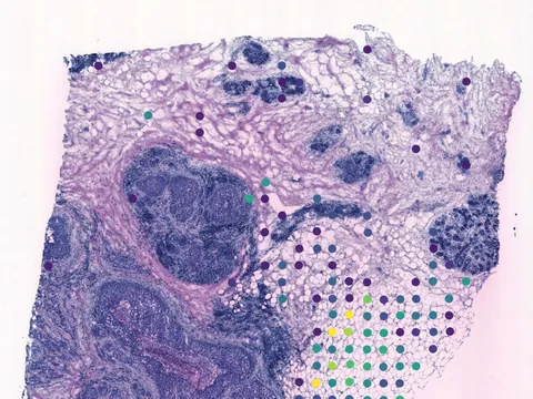 Human breast preview