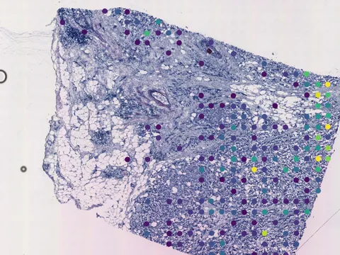 Human breast preview