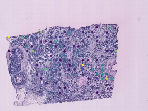Human breast preview