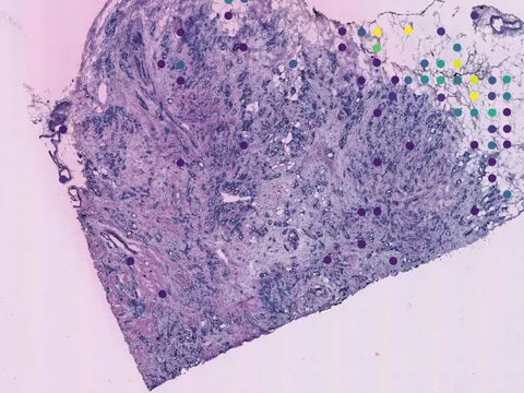 Human breast preview