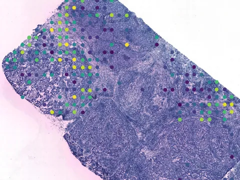 Human breast preview