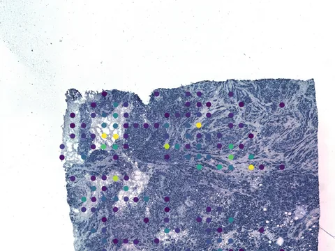 Human breast preview