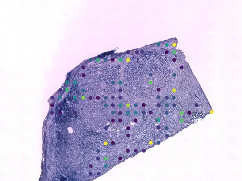 Human breast preview