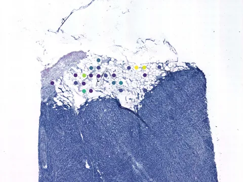 Human breast preview