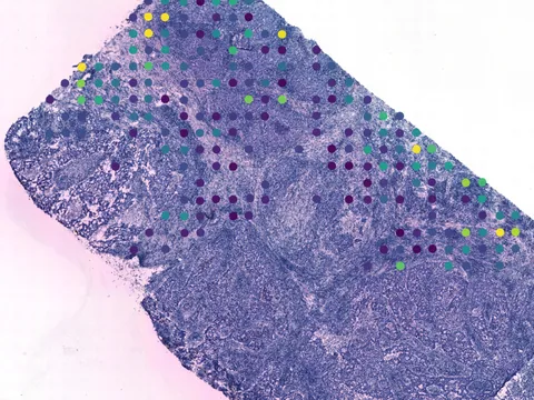 Human breast preview