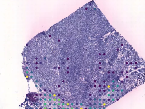 Human breast preview