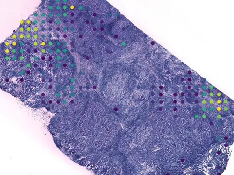 Human breast preview