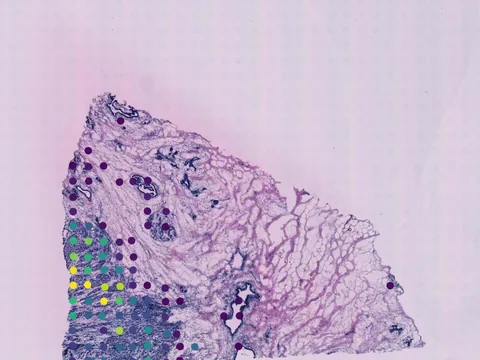 Human breast preview