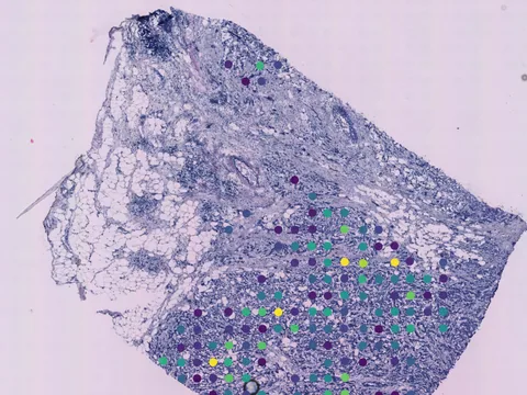 Human breast preview