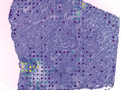 Human breast preview