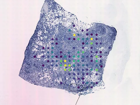 Human breast preview