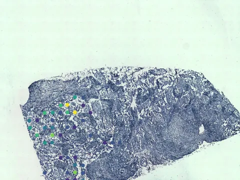 Human breast preview