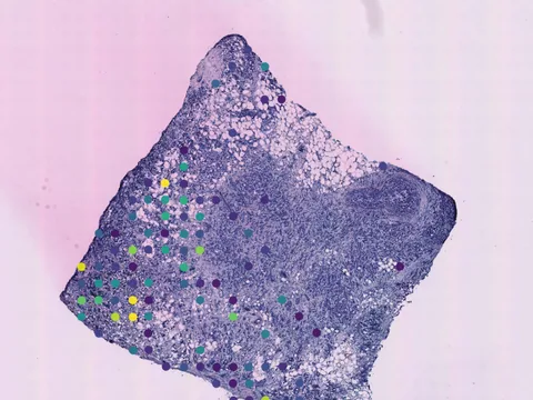 Human breast preview