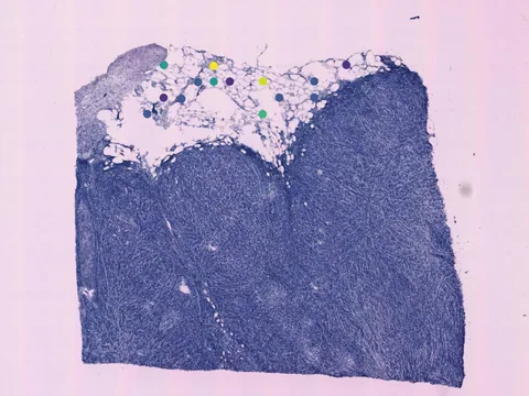 Human breast preview