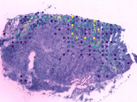 Human breast preview