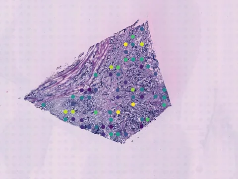 Human breast preview