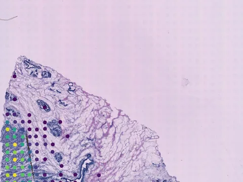 Human breast preview