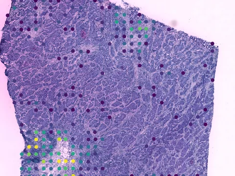 Human breast preview