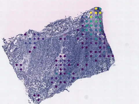 Human breast preview