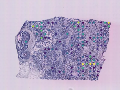 Human breast preview