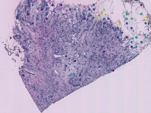 Human breast preview