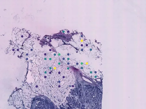 Human breast preview