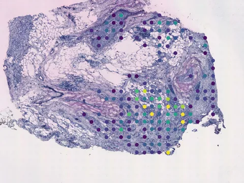 Human breast preview