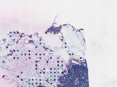 Human breast preview