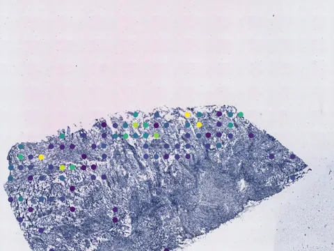 Human breast preview