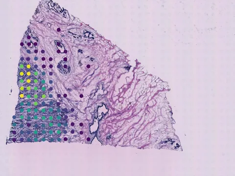 Human breast preview