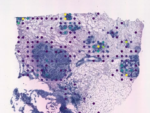 Human breast preview