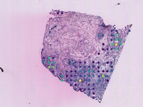 Human breast preview