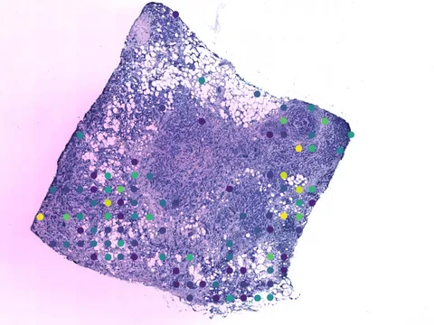 Human breast preview