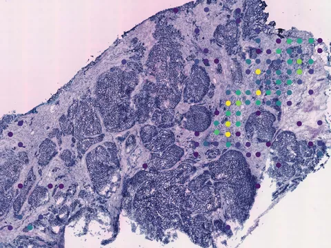 Human breast preview