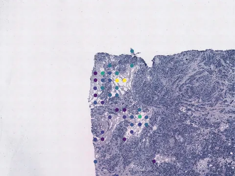 Human breast preview