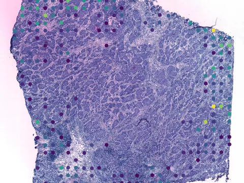 Human breast preview