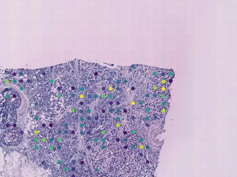Human breast preview