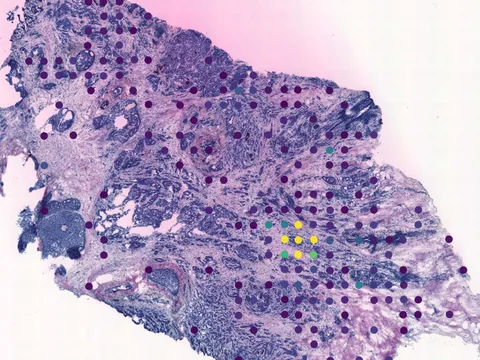 Human breast preview
