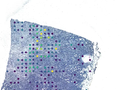 Human breast preview