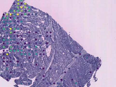 Human breast preview