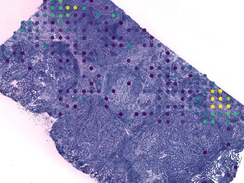 Human breast preview