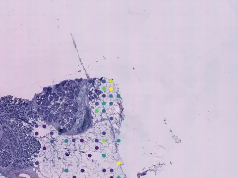 Human breast preview