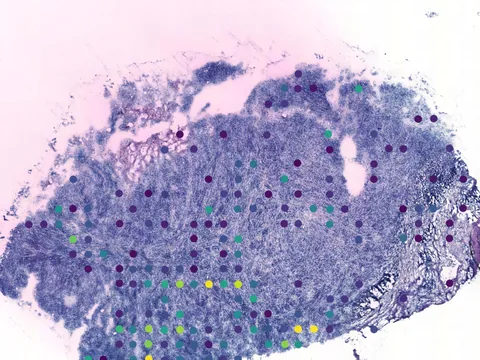 Human breast preview