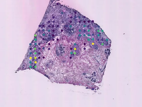 Human breast preview